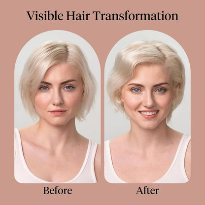 Kitsch Argan Oil Conditioner for Hair Growth – Made in USA, 12 oz