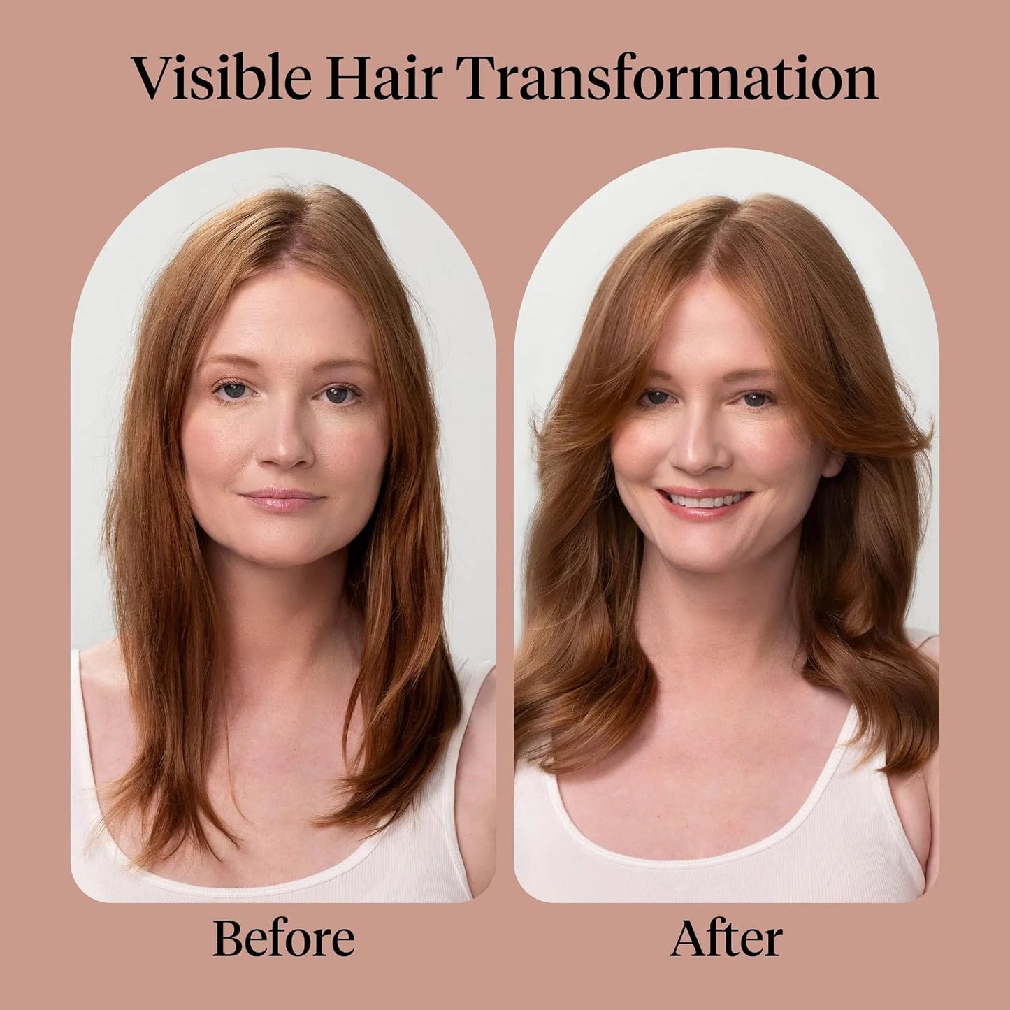 Kitsch Rosemary & Biotin Conditioner for Hair Growth – Made in USA, 12 oz