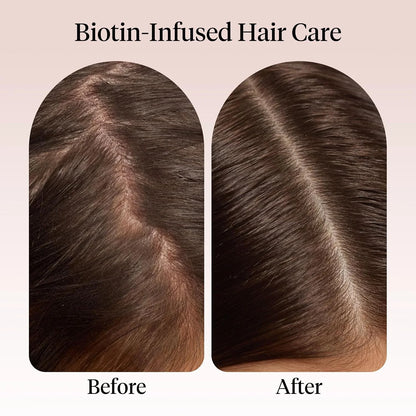 Kitsch Rosemary Oil for Hair Growth -With Castor Oil, Biotin & Jojoba- 60mL