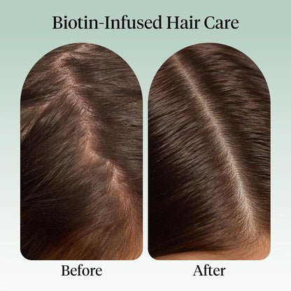 Kitsch Rosemary Oil for Hair Growth -With Castor Oil, Biotin & Jojoba- 60mL